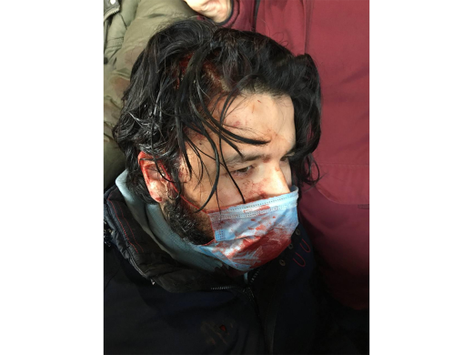 Shukhrat Shiroliev's head was smashed during detention. According to him, he was detained at the monument to Peter the Great in St. Petersburg, knocked to the ground and beaten with police truncheons. March 6, 2022 / Photo provided by other detainees