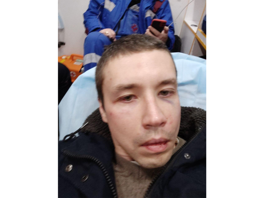 Anton Mishchenko, detained in Moscow, said that he was beaten for filming police officers at the Marino police station. According to the ambulance doctors, Mishchenko has a concussion. March 6, 2022 / Photo provided by Mishchenko