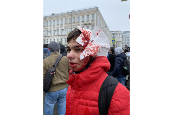 Избитый в Москве / Фото: «Протестная Россия»